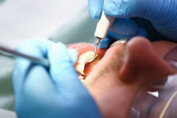 Best Weekend Emergency Dentist in Nebo, NC