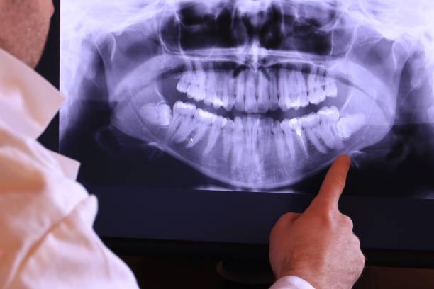 Best Pediatric Emergency Dentist in Nebo, NC