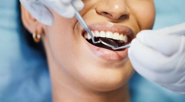 Best Emergency Dentist for Lost Fillings or Crowns in Nebo, NC